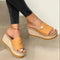 Orthopedic Arch Support Women's Sandals for Summer Comfort and Style 2